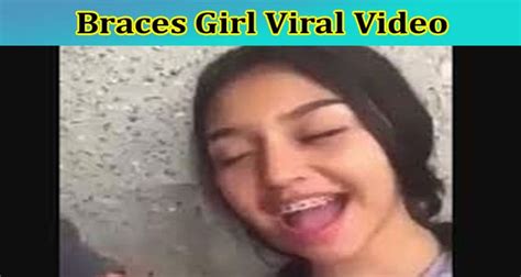 girl with braces leaked|[Full Original Video] Braces Girl Viral Video: Check The Content。